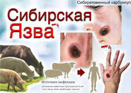 Сиби́рская я́зва острая инфекционная болезнь животных, характеризующаяся тяжёлой интоксикацией организма.
